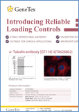 Introducing Reliable Loading Controls