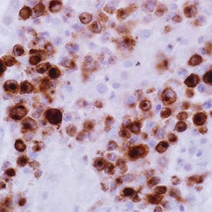 Epstein Barr Virus, CS1-4, mouse