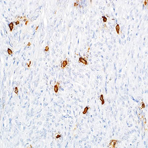 Tryptase