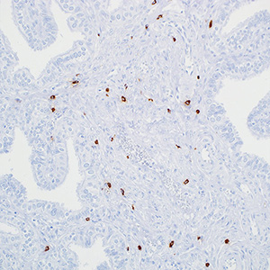 Tryptase