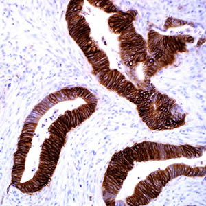 Cadherin-17