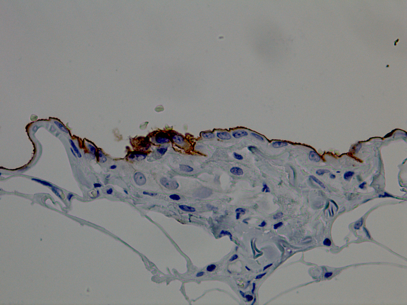 Mesothelin