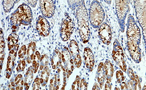 Osteopontin (SPP1)