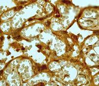 GeneTex MMP-8 antibody [EP1252Y]