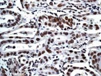 GeneTex ATM (phospho Ser1981) antibody [EP1890Y]