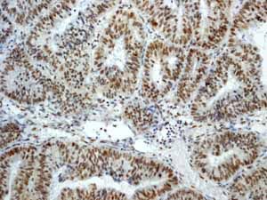 GeneTex ATM (phospho Ser1981) antibody [EP1890Y]