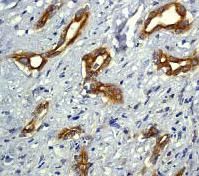 GeneTex Bcl-10 antibody [EP606Y], C-term
